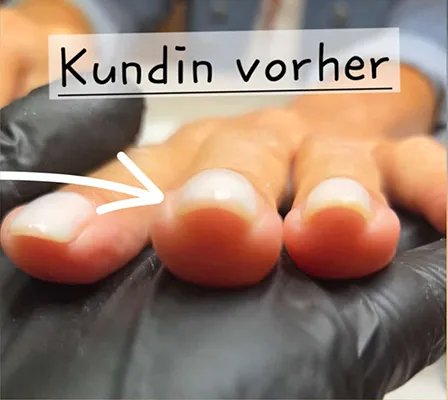 Nageldesign vorher